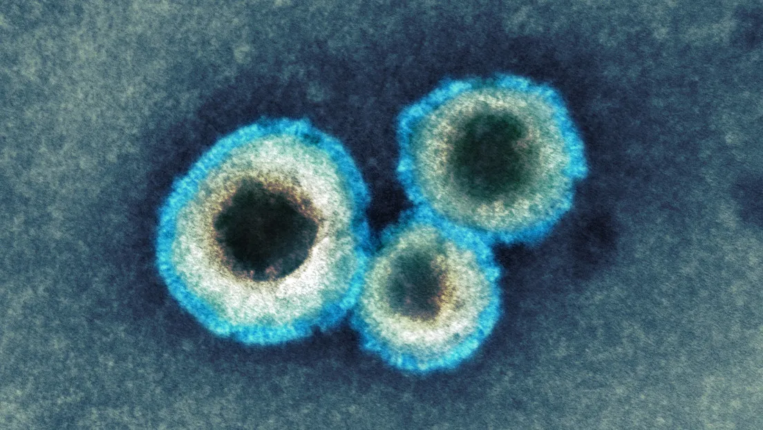 Micrografía electrónica de transmisión coloreada de partículas del metapneumovirus humano.
