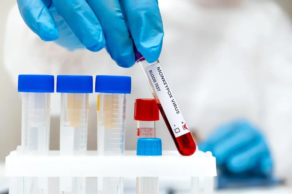 PW-Viruela-simica-1500x1000