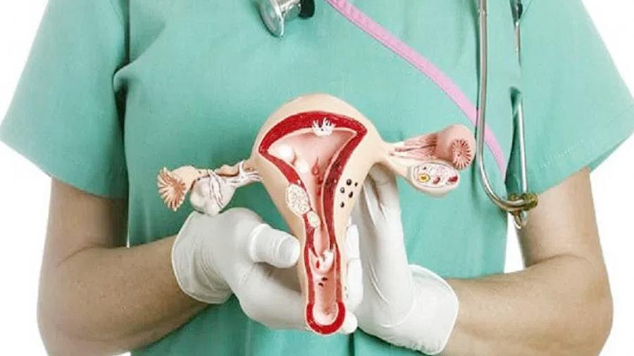 cáncer uterino I